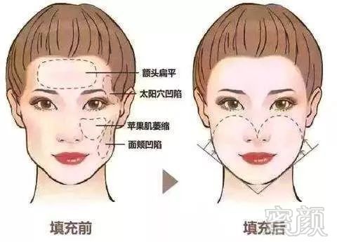 https://img.miyanlife.com/mnt/timg/190701/11533132A-4.jpg