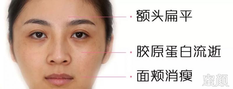 https://img.miyanlife.com/mnt/timg/190701/1153323096-5.jpg