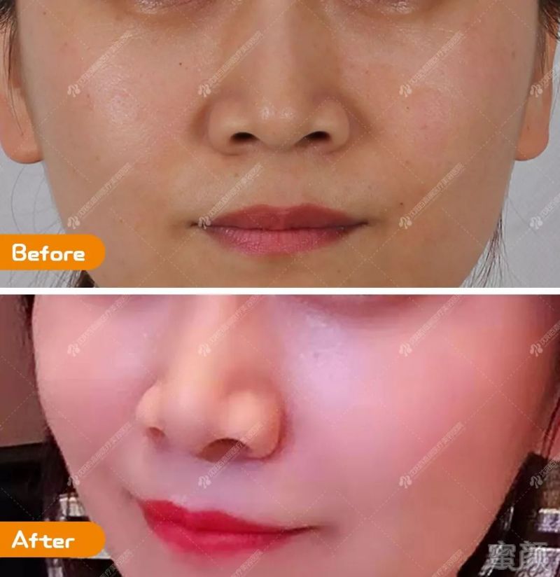 https://img.miyanlife.com/mnt/timg/190701/1153351U6-13.jpg