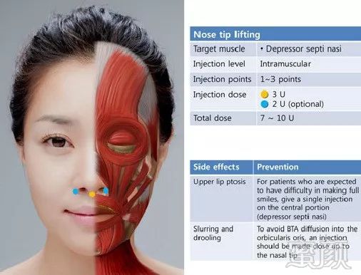 https://img.miyanlife.com/mnt/timg/190702/1125194M6-12.jpg