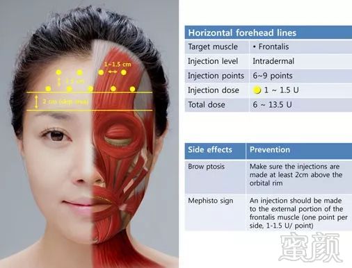 https://img.miyanlife.com/mnt/timg/190702/11251G4A-4.jpg