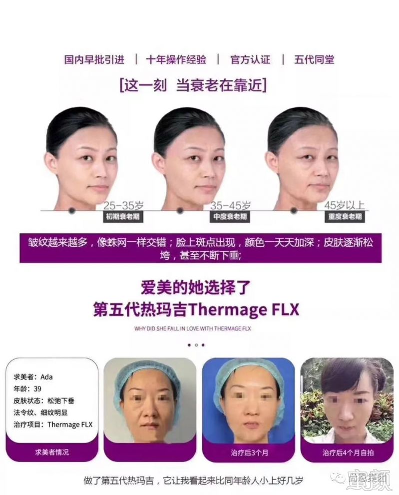 https://img.miyanlife.com/mnt/timg/190702/120002FK-4.jpg