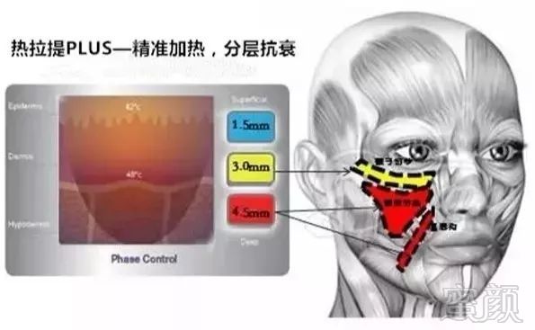 案例图片