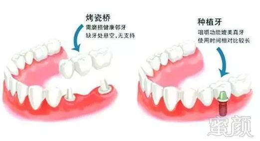 案例图片