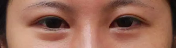 https://img.miyanlife.com/mnt/timg/190702/12251AL8-2.jpg