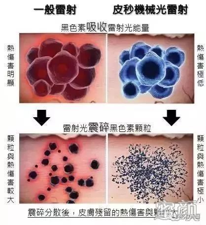 https://img.miyanlife.com/mnt/timg/190703/11554HE9-1.jpg
