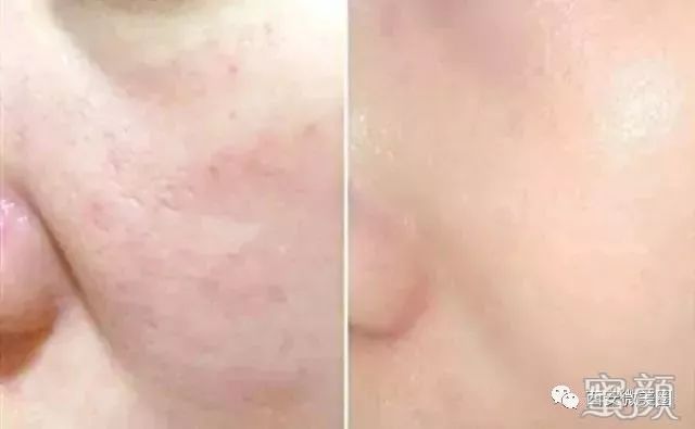https://img.miyanlife.com/mnt/timg/190703/11554Ma9-4.jpg