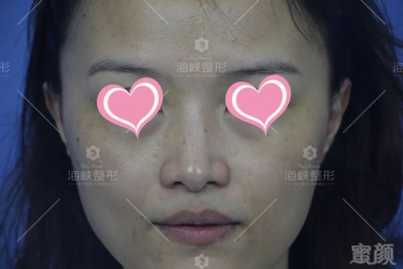 https://img.miyanlife.com/mnt/timg/190703/1205022E7-3.jpg