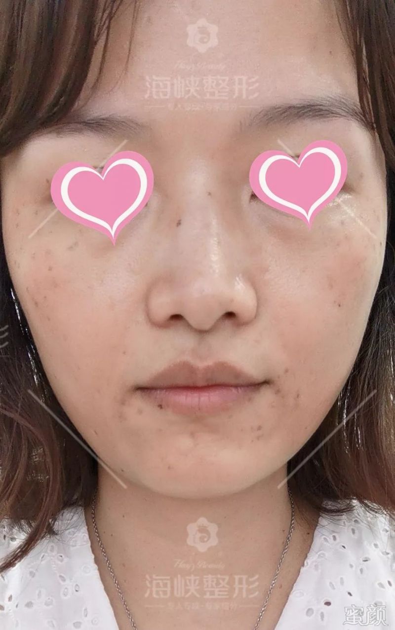 https://img.miyanlife.com/mnt/timg/190703/1205151O2-10.jpg