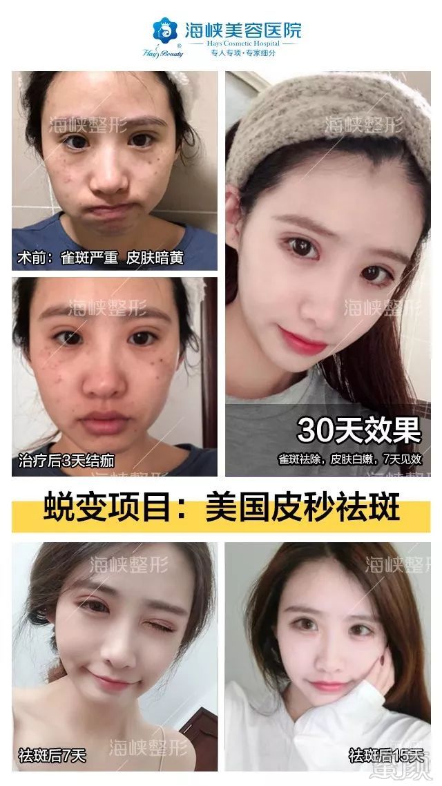 https://img.miyanlife.com/mnt/timg/190703/1205191V1-12.jpg