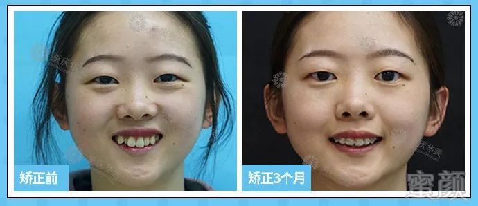 https://img.miyanlife.com/mnt/timg/190703/120Q34129-6.jpg