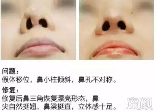 https://img.miyanlife.com/mnt/timg/190703/1214293I5-2.jpg