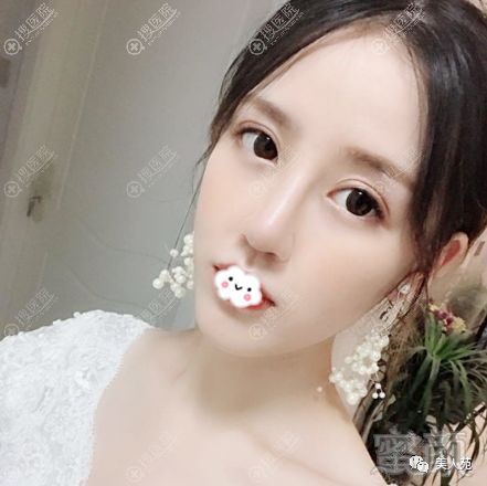 https://img.miyanlife.com/mnt/timg/190703/12154LA4-3.jpg