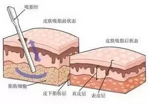 案例图片