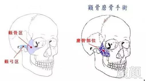 案例图片