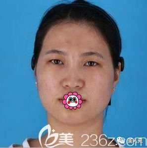 https://img.miyanlife.com/mnt/timg/190704/1132222C2-0.jpg