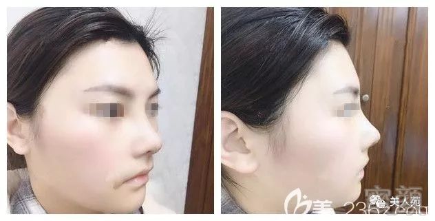 https://img.miyanlife.com/mnt/timg/190704/1132561Y1-3.jpg