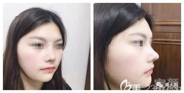 https://img.miyanlife.com/mnt/timg/190704/11325R126-4.jpg