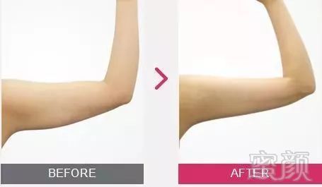 https://img.miyanlife.com/mnt/timg/190704/11351433B-6.jpg