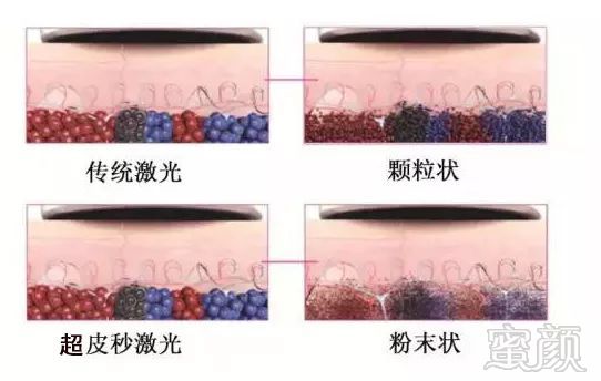 https://img.miyanlife.com/mnt/timg/190704/114FG246-1.jpg