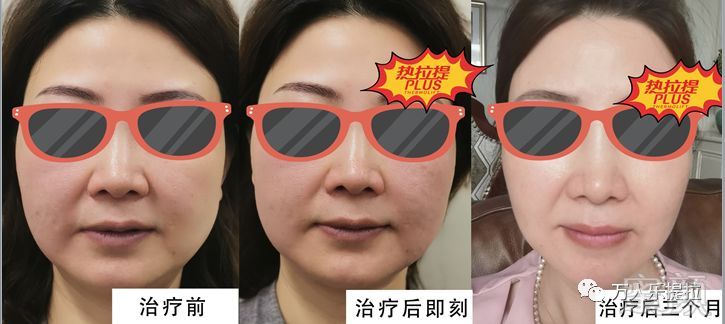 https://img.miyanlife.com/mnt/timg/190704/114P63D4-8.jpg