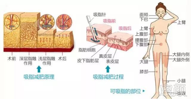 https://img.miyanlife.com/mnt/timg/190704/120PT4Q-11.jpg