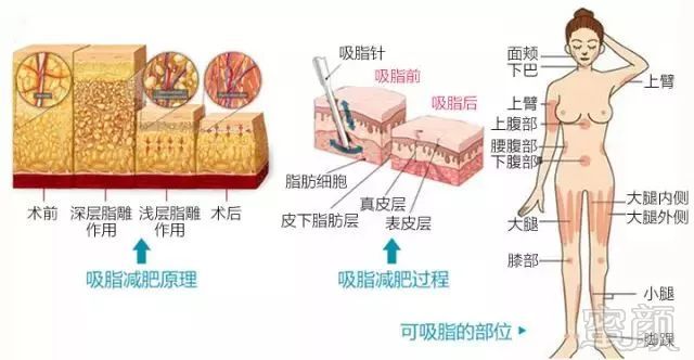 案例图片