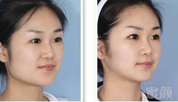 https://img.miyanlife.com/mnt/timg/190704/121TV4E-9.jpg