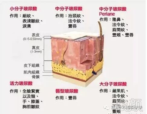 https://img.miyanlife.com/mnt/timg/190705/11010134a-0.jpg