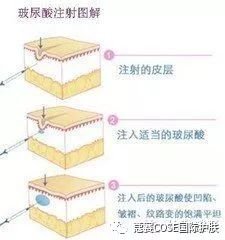https://img.miyanlife.com/mnt/timg/190705/1101021632-2.jpg