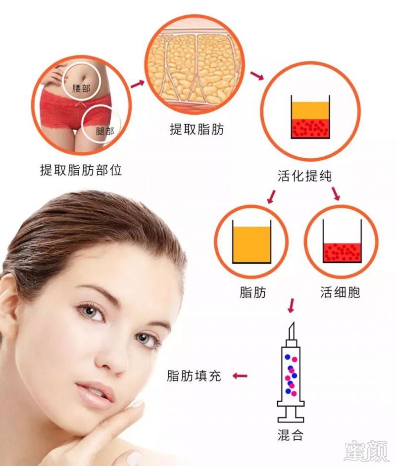 https://img.miyanlife.com/mnt/timg/190705/1101493958-0.jpg