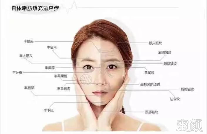 https://img.miyanlife.com/mnt/timg/190705/110150A15-1.jpg