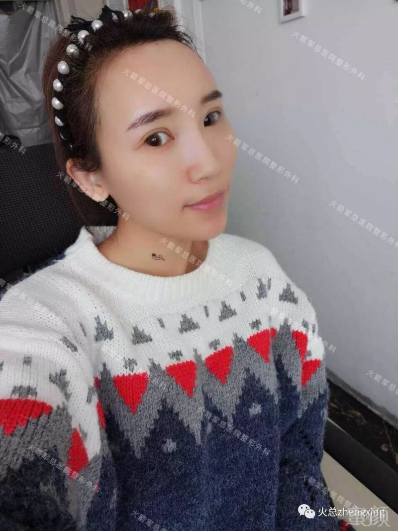 https://img.miyanlife.com/mnt/timg/190705/1101553B9-7.jpg