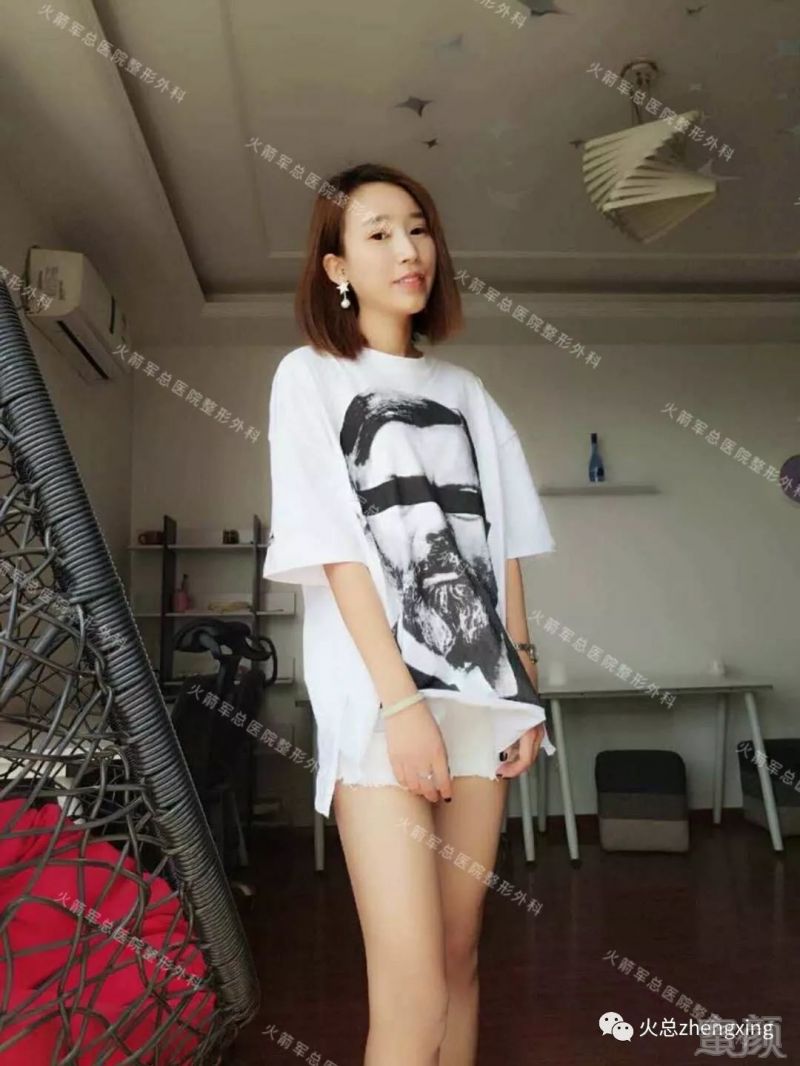 https://img.miyanlife.com/mnt/timg/190705/11015S512-11.jpg