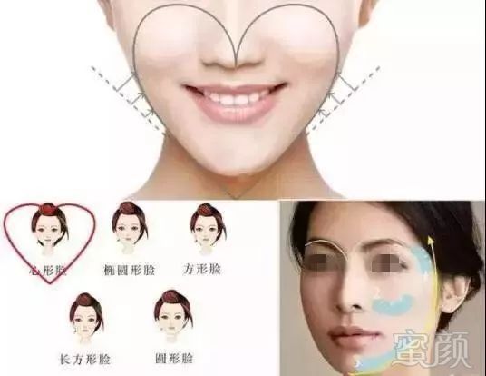 https://img.miyanlife.com/mnt/timg/190705/1112143B2-9.jpg