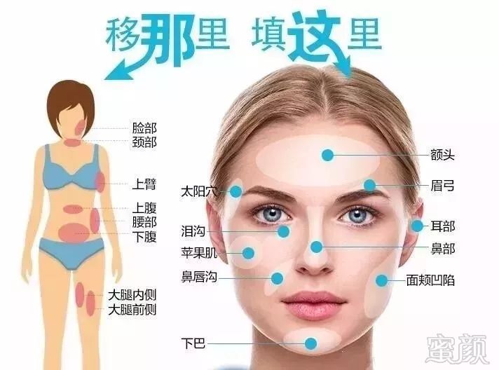 https://img.miyanlife.com/mnt/timg/190705/1112145604-10.jpg