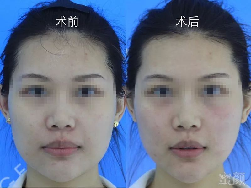 https://img.miyanlife.com/mnt/timg/190705/1129511R2-3.jpg