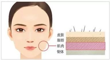 https://img.miyanlife.com/mnt/timg/190705/113P920b-4.jpg