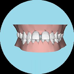 https://img.miyanlife.com/mnt/timg/190705/1146024Y1-3.jpg
