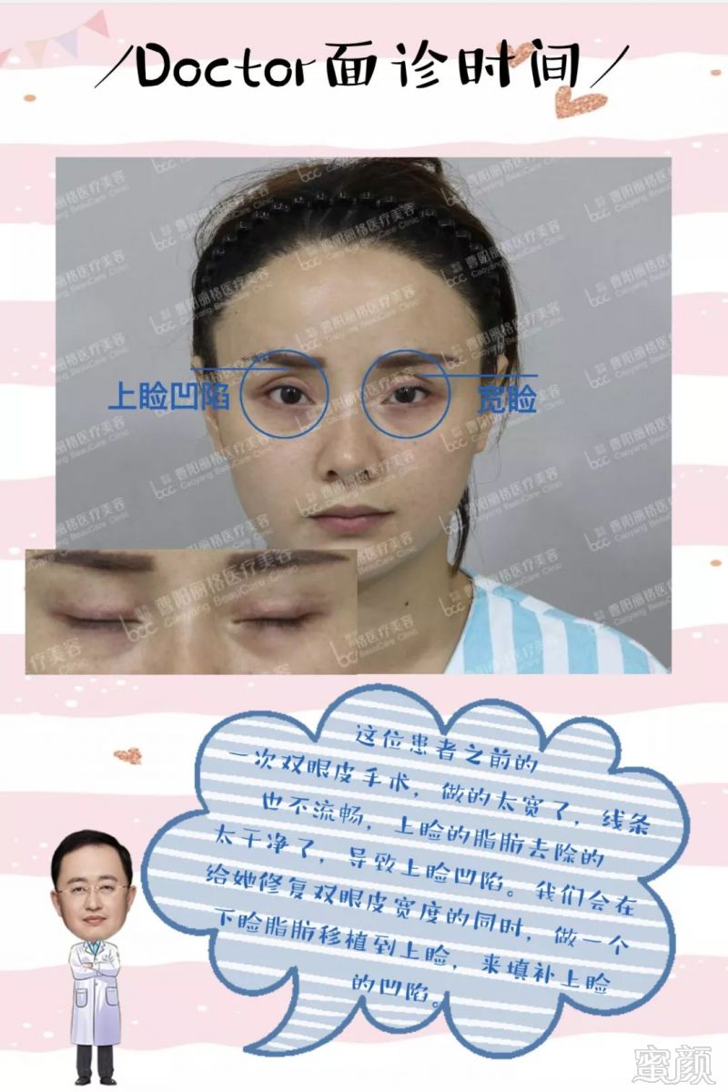 https://img.miyanlife.com/mnt/timg/190706/12105K260-1.jpg