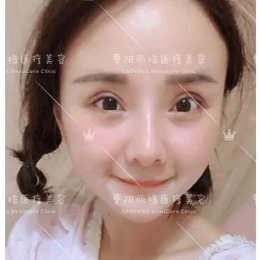 https://img.miyanlife.com/mnt/timg/190706/12105U345-4.jpg
