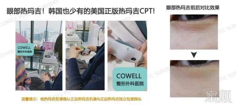 https://img.miyanlife.com/mnt/timg/190706/1220053Q0-2.jpg
