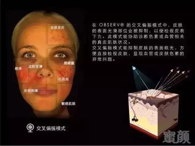 https://img.miyanlife.com/mnt/timg/190707/10491I324-2.jpg