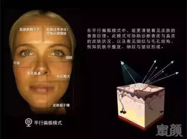 https://img.miyanlife.com/mnt/timg/190707/10491Q3R-3.jpg