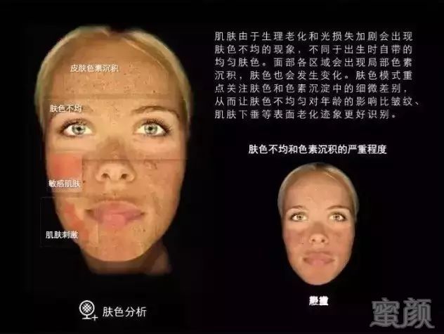 https://img.miyanlife.com/mnt/timg/190707/1049205Q9-6.jpg