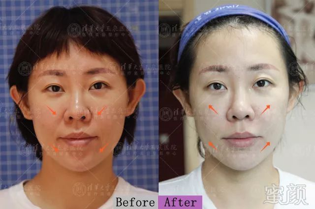 https://img.miyanlife.com/mnt/timg/190707/11343a1O-3.jpg