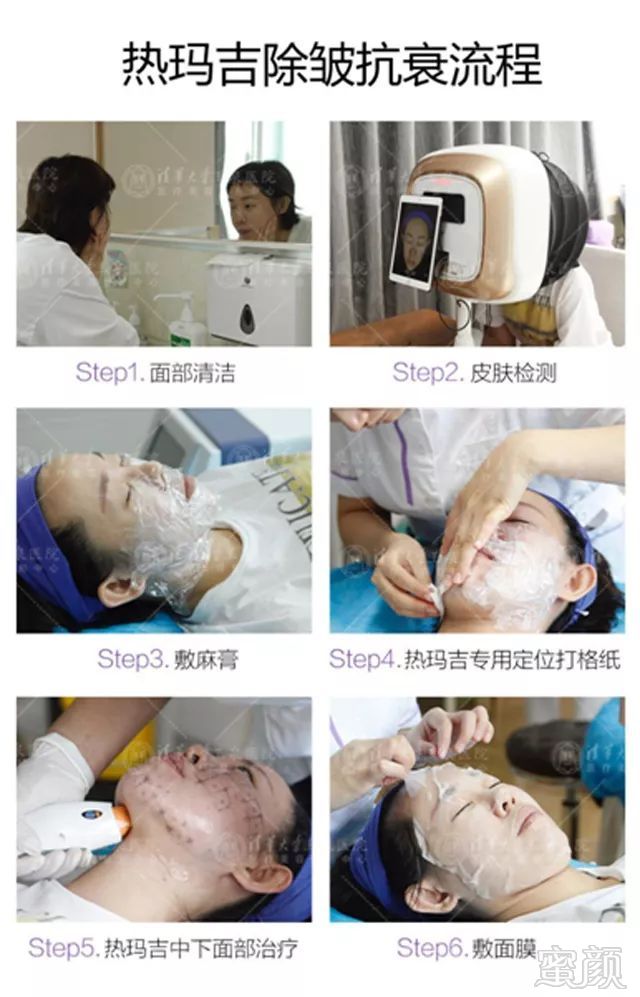 https://img.miyanlife.com/mnt/timg/190707/1134401I1-5.jpg