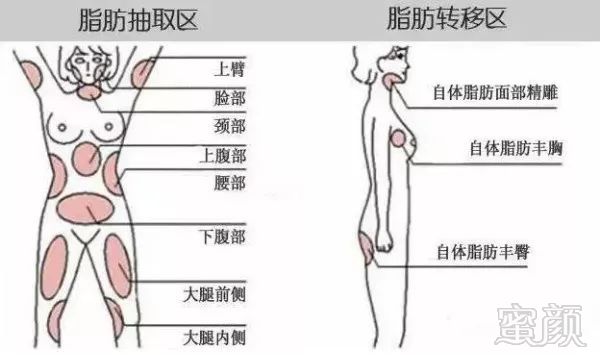 案例图片