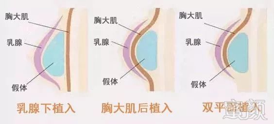 https://img.miyanlife.com/mnt/timg/190707/121223G60-16.jpg