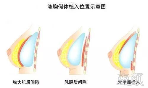 https://img.miyanlife.com/mnt/timg/190707/1212244950-18.jpg